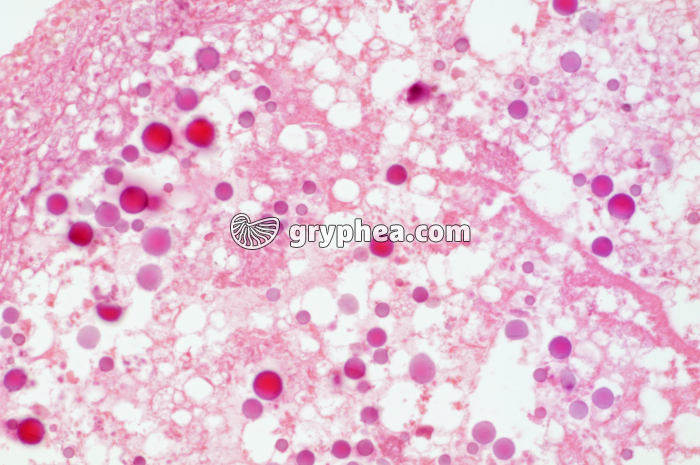 Vitellus de l'oeuf d'oiseau x100 - gryphea.com